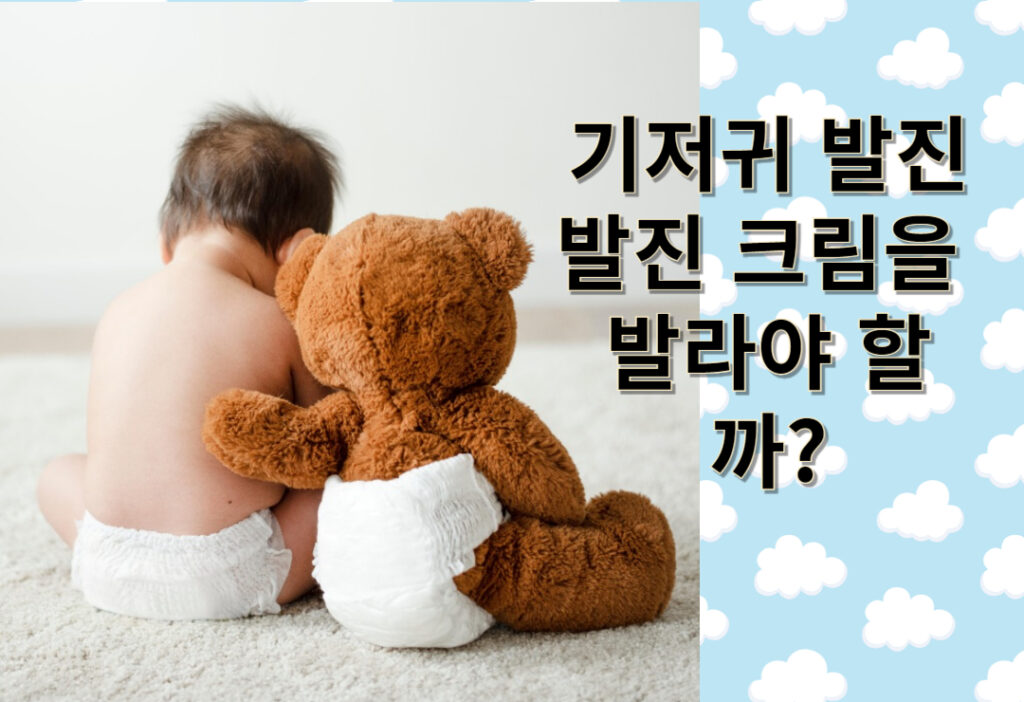 기저귀 발진이 생겼을 때 발진 크림을 발라야 할까?