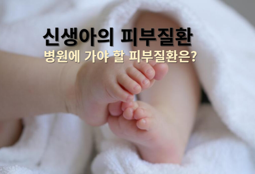 흔한 신생아의 피부질환, 병원에 가야할 증상은?