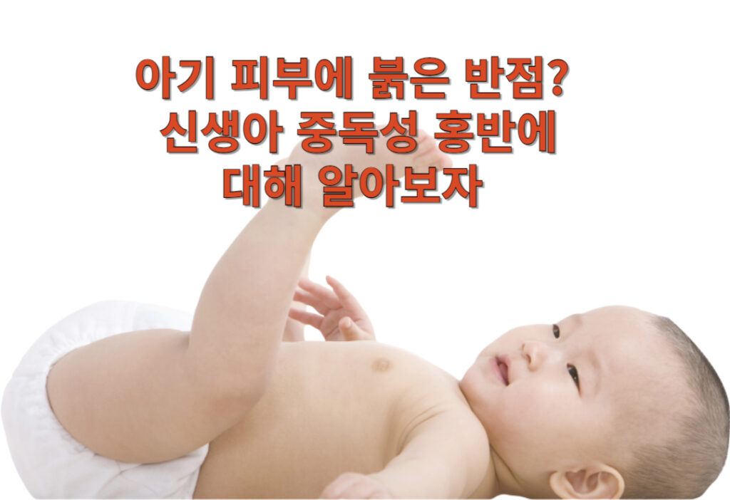 아기 피부에 붉은 반점? 신생아 중독성 홍반에 대해 알아보자