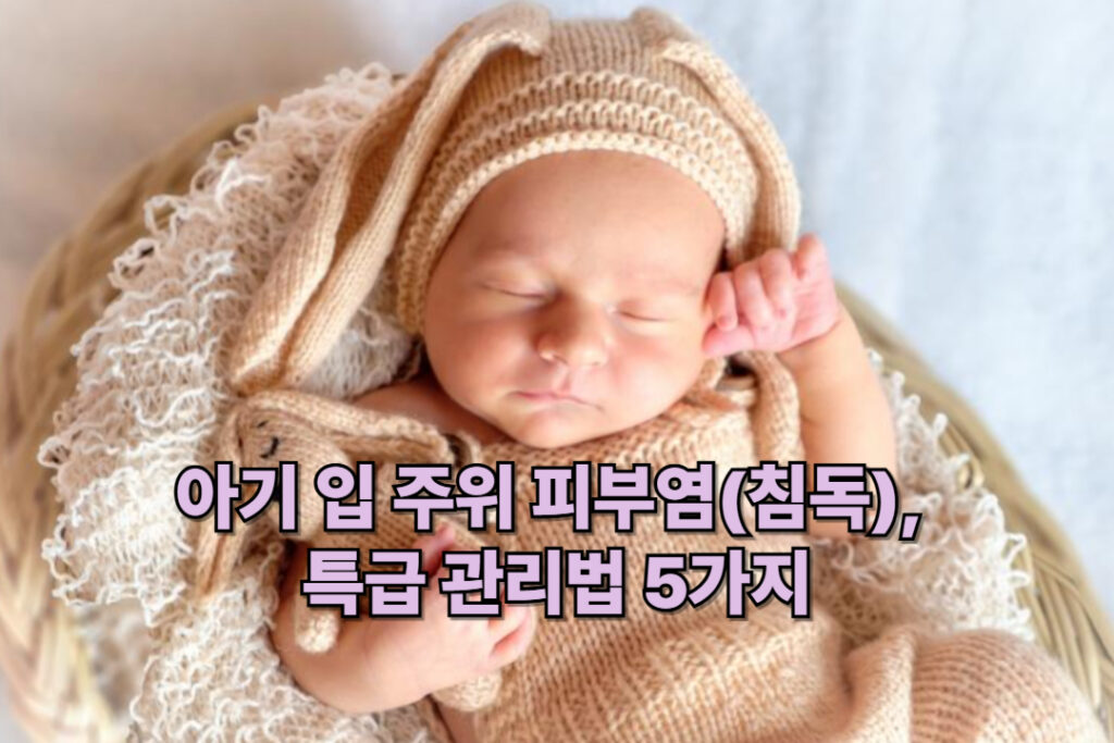 아기 입 주위 피부염(침독)  특급 관리법 5가지